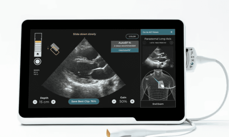 GE HealthCare scores $44M Gates Foundation grant for AI-powered ultrasound