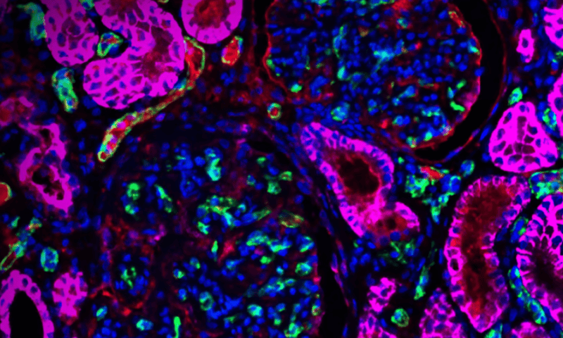 ‘Unprecedented’: CRISPR-edited pig kidney lasts for 2 years in primates