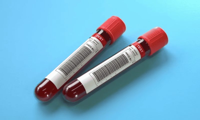 Labcorp launches tri-biomarker blood test to aid Alzheimer’s diagnosis