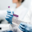 FDA, CMS issue joint letter supporting increased oversight of lab-developed tests