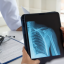 Samsung taps Lunit to bring AI detection to its chest X-ray scanners