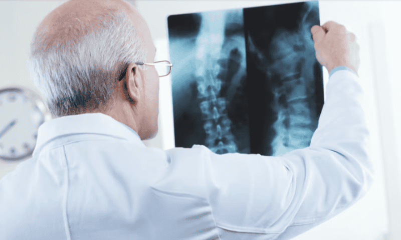 ZimVie begets Highridge Medical with completed spine business spinout