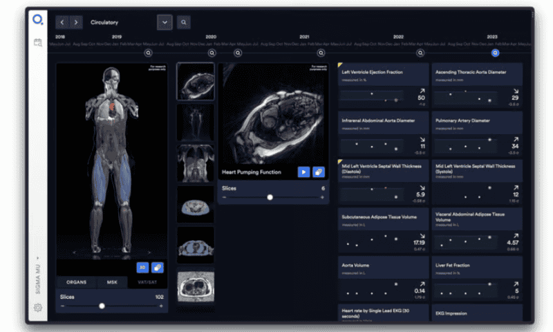 Old MRI, new tricks: Q Bio puts forward quantifiable, reproducible scanning approach