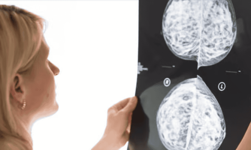 New breast cancer guidelines call for first mammogram at age 40 but stop short of annual screening