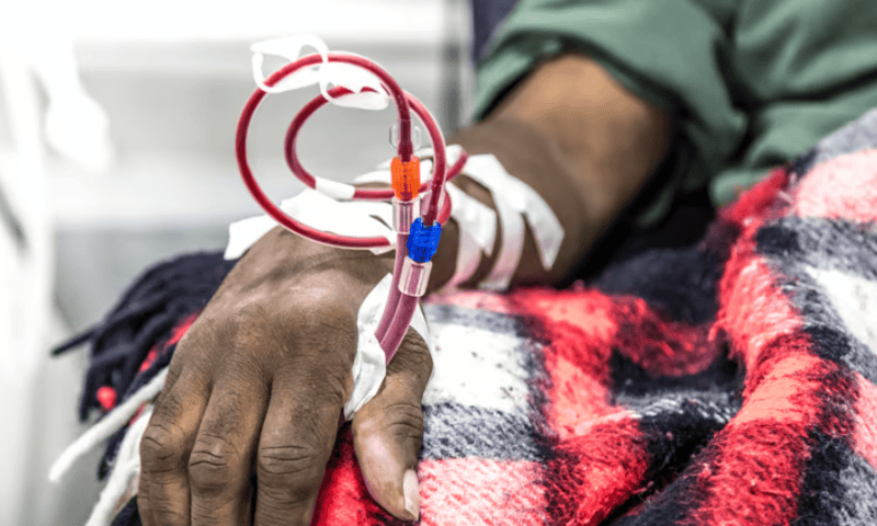 Invizius completes first-in-human dialysis trial to quell ‘angry blood’