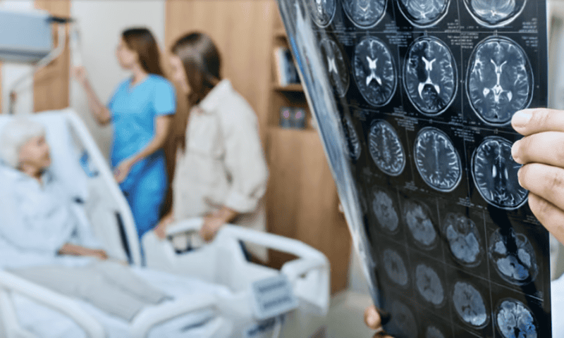 GE HealthCare claims FDA clearance for amyloid imaging software in Alzheimer’s disease