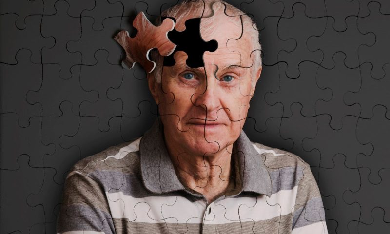 AI Model Measures Pace of Brain Aging, Could Aid Prediction of Cognitive Decline