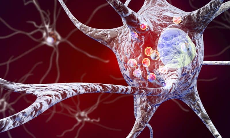 Cholesterol Metabolite Implicated in Parkinson’s Disease Pathology