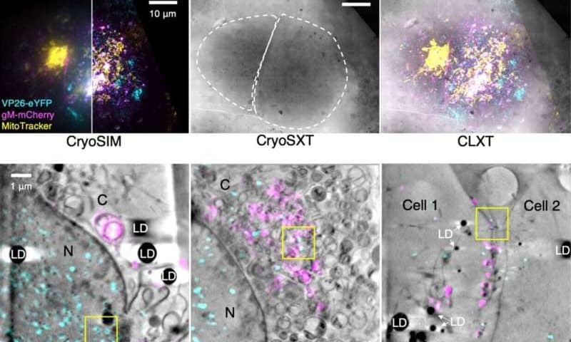 3D imaging approach reveals intricate steps of herpes simplex virus assembly