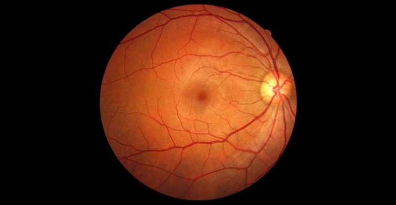 A Sign Deep Inside Your Eyes Could Warn of Early Dementia