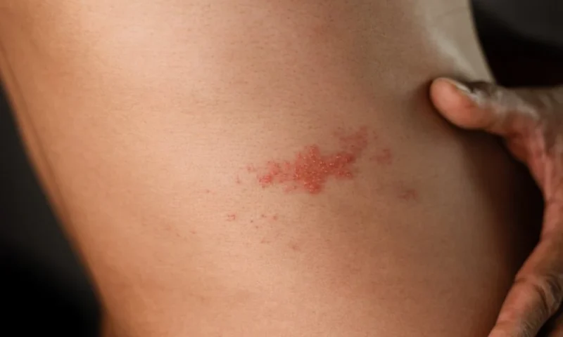 The Shingles Vaccine Could Be a Secret Weapon Against Heart Attacks