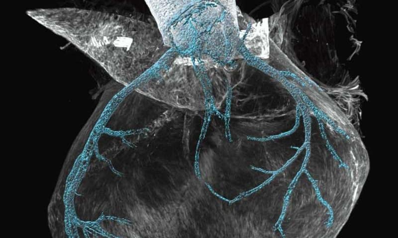 Touch-sensing PIEZO2 ion channel found to also play essential role in coronary vessel development