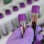 Blood test identifies HPV-associated head and neck cancers up to 10 years before symptoms