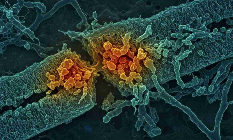 Rush of Targeted Myasthenia Gravis Therapies Hit Once Sparse Market