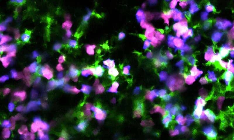 Blood cancer: Scientists reprogram cancer cell death to trigger immune system