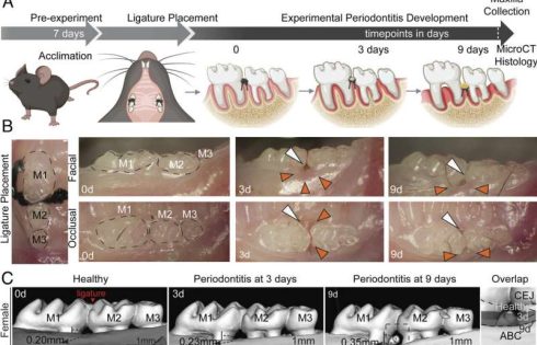 Inflammasome found to drive male-specific bone loss in gum disease