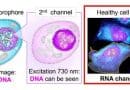 Simultaneous imaging of intracellular DNA and RNA using harmless light