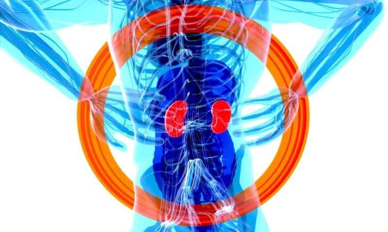 Pegcetacoplan—the ‘closest thing to a cure’ for rare, severe kidney disease