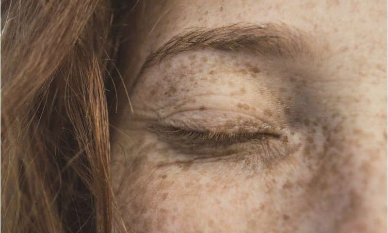 Lower doses of immunotherapy for skin cancer give better results, study suggests