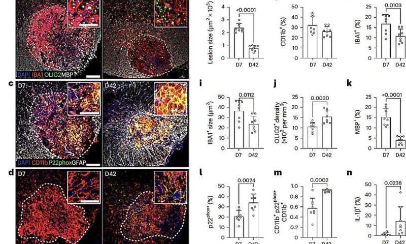 The role of neuroinflammation in progressive multiple sclerosis
