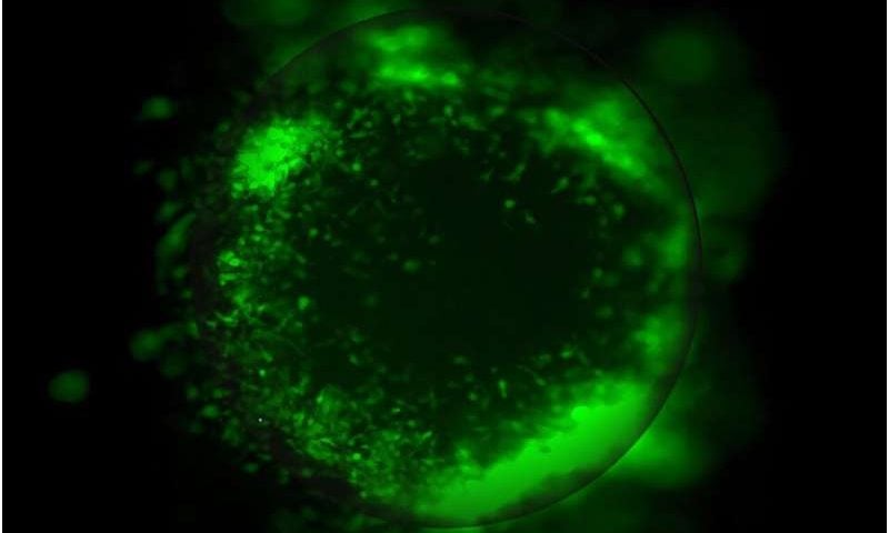 Lab-grown organoids reveal how glioblastoma outsmarts treatment