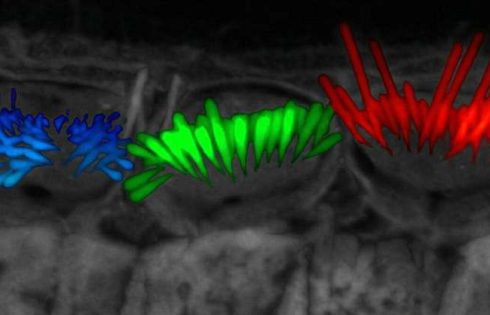 Unprecedented 3D views of sensory cells accelerate hearing research
