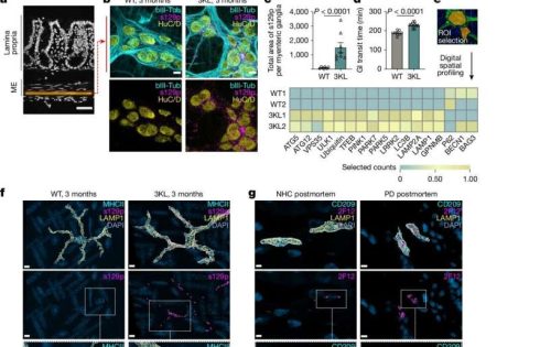 Targeting the gut’s immune system could tackle early stages of Parkinson’s