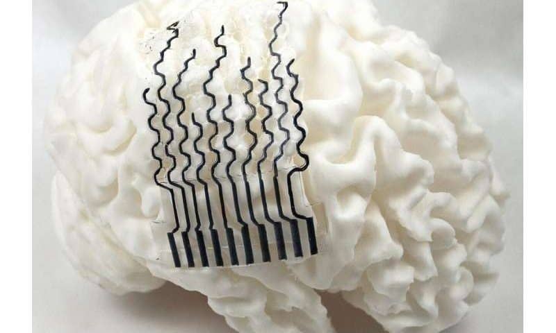 3D-printed brain sensors may unlock personalized neural monitoring