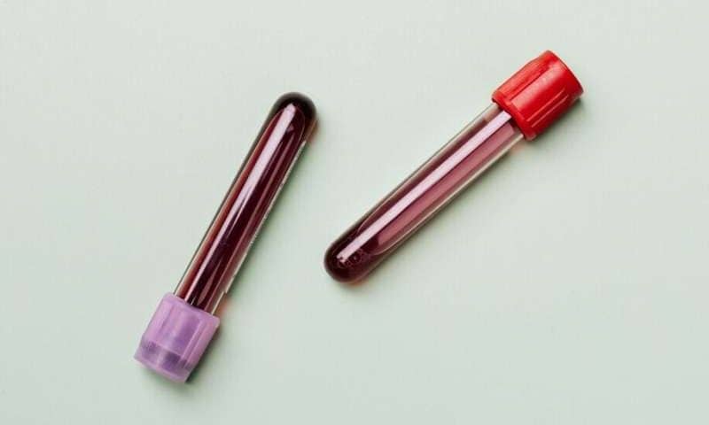 Blood test predicts kidney failure risk to Black Americans years before onset