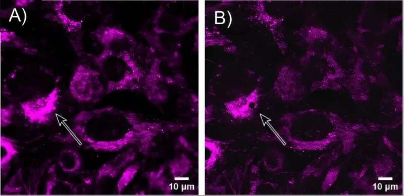 New technique maps cancer drug uptake inside living cells