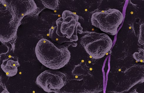 Smart Investors Track These Oncology Pipeline Catalysts Driving Massive Biotech Valuations