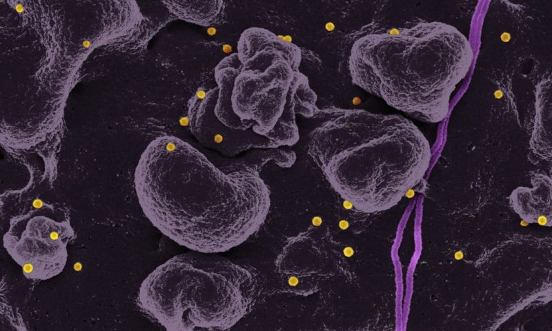 Smart Investors Track These Oncology Pipeline Catalysts Driving Massive Biotech Valuations