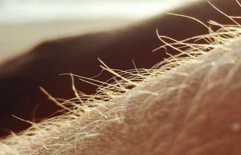 Hidden in hair follicles, immune ‘sentinel’ cells may help skin detect microbes