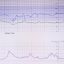 Critical Phase 3 Trial Results Signal Major Shifts for Biotech Investment Strategies