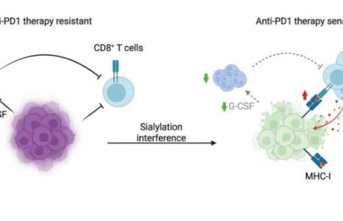 Breast tumors use sugar coating to evade immunity, opening potential immunotherapy path