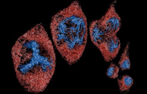 Hi-res microscopes give biologists petabytes of data. Scientists are creating an AI assistant to make sense of it