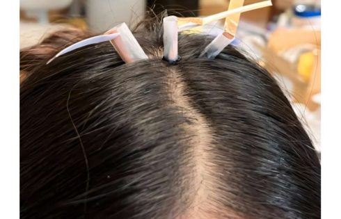 Thermoreversible biogel may solve a hairy problem for wearable brain-monitoring systems