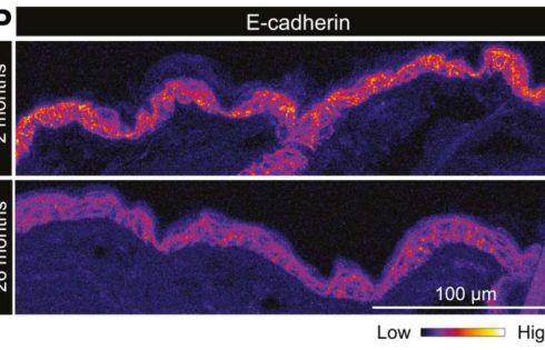 Unprecedented view inside live stem cells reveals aging process and loss of regenerative capacity