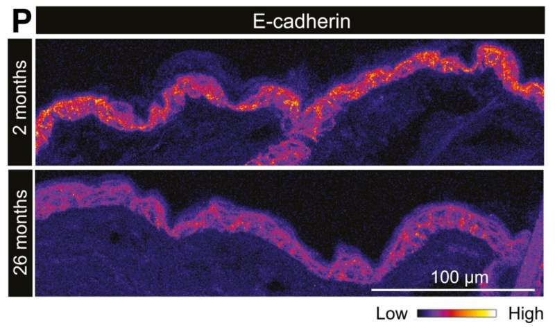 Unprecedented view inside live stem cells reveals aging process and loss of regenerative capacity