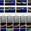 New AI tools could help eye doctors diagnose retinal disease faster