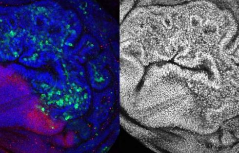 Some tumors eliminate healthy neighboring cells to grow, study reveals