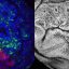 Some tumors eliminate healthy neighboring cells to grow, study reveals